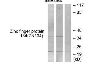 Western blot analysis of extracts from COS-7 cells and K562 cells, using ZNF134 antibody. (ZNF134 抗体  (Internal Region))