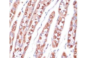 Immunohistochemistry of paraffin-embedded Human stomach using UBE2O Polyclonal Antibody at dilution of 1:100 (40x lens). (UBE2O 抗体)