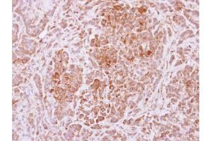 IHC-P Image Immunohistochemical analysis of paraffin-embedded A549 xenograft, using USP4, antibody at 1:500 dilution. (USP4 抗体  (Center))