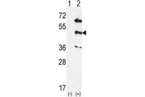 Western Blotting (WB) image for anti-Mitogen-Activated Protein Kinase 12 (MAPK12) antibody (ABIN5023083) (MAPK12 抗体)