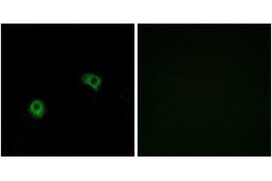 Immunofluorescence analysis of A549 cells, using GPR116 Antibody. (G Protein-Coupled Receptor 116 抗体  (AA 1121-1170))