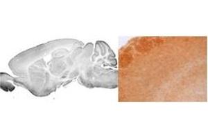 Immunohistochemistry (IHC) image for anti-gamma-aminobutyric Acid (GABA) A Receptor, alpha 3 (GABRA3) (Middle Region) antibody (ABIN2776110)