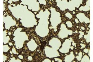 ABIN6276289 at 1/100 staining Mouse lung tissue by IHC-P. (ATF6 抗体  (Internal Region))