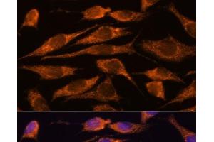 Immunofluorescence analysis of L929 cells using MTMR9 Polyclonal Antibody at dilution of 1:100. (MTMR9 抗体)
