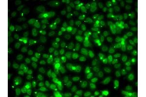 Immunofluorescence analysis of MCF7 cells using RP antibody (ABIN6128654, ABIN6147085, ABIN6147087 and ABIN6218282). (RPA3 抗体  (AA 6-121))
