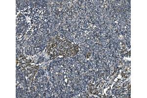 IHC analysis of eRF1/ETF1 using anti-eRF1/ETF1 antibody (ABIN7602626).