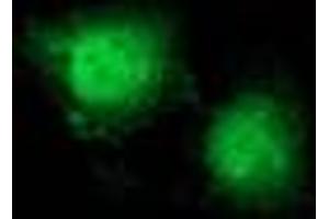 Image no. 9 for anti-Catenin (Cadherin-Associated Protein), beta 1, 88kDa (CTNNB1) antibody (ABIN1496890) (CTNNB1 抗体)