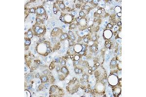 Immunohistochemistry (IHC) image for anti-Perilipin 2 (PLIN2) (AA 168-437) antibody (ABIN6145773)