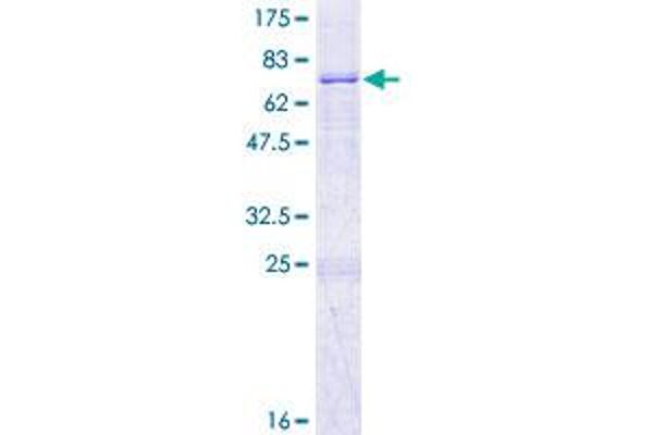 MMAA Protein (AA 1-418) (GST tag)