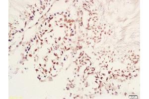 Formalin-fixed and paraffin embedded rat testis labeled with Rabbit Anti-MAP1LC3A(Ser12) Polyclonal Antibody, Unconjugated (ABIN710591) at 1:200 followed by conjugation to the secondary antibody and DAB staining