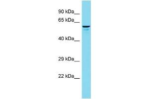 Host: Rabbit Target Name: FRMD1 Sample Type: 293T Whole Cell lysates Antibody Dilution: 1. (FRMD1 抗体  (N-Term))