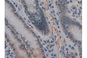 Detection of GPLD1 in Human Stomach Tissue using Polyclonal Antibody to Glycosylphosphatidylinositol Specific Phospholipase D1 (GPLD1)