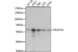 Western blot analysis of extracts of various cell lines, using MGA antibody (ABIN7268393) at 1:1000 dilution. (MGAT4A 抗体  (AA 28-100))