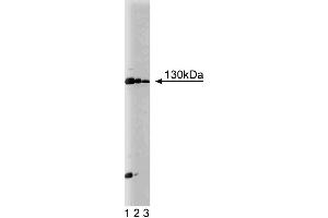 Western blot analysis of JAK1 on Jurkat cell lysate. (JAK1 抗体  (AA 551-766))