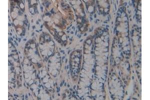 Detection of DAPP1 in Mouse Small intestine Tissue using Polyclonal Antibody to Dual Adaptor Of Phosphotyrosine And 3-Phosphoinositides (DAPP1)