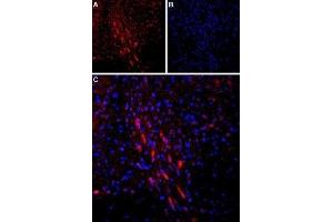 Expression of Parathyroid hormone receptor 1 in rat brain - Immunohistochemical staining of rat dorsal Raphe nucleus using Anti-PTH1R (extracellular) Antibody (ABIN7043429, ABIN7045112 and ABIN7045113). (PTH1R 抗体  (Extracellular))