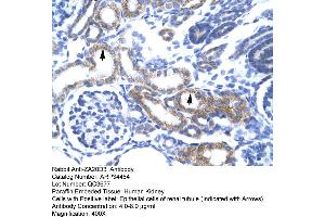 Immunohistochemistry (IHC) image for anti-Zinc Finger, AN1-Type Domain 6 (ZFAND6) (Middle Region) antibody (ABIN2775809)