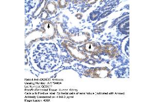 Human kidney (ZFAND6 抗体  (Middle Region))