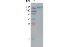 Human Protein, His Tag on SDS-PAGE under reducing condition.