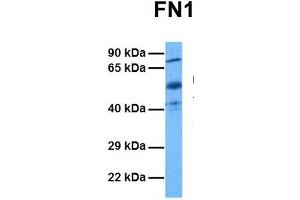 Host:  Rabbit  Target Name:  FN1  Sample Tissue:  Human Ovary Tumor  Antibody Dilution:  1. (Fibronectin 1 抗体  (C-Term))