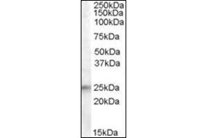 Western Blot: Antibody (0. (IGFBP6 抗体  (Internal Region))