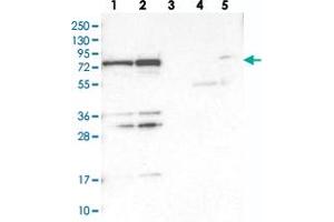 Western blot analysis of Lane 1: RT-4, Lane 2: U-251 MG, Lane 3: Human Plasma, Lane 4: Liver, Lane 5: Tonsil with PTCD1 polyclonal antibody . (PTCD1 抗体)