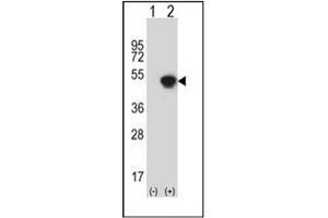 Western blot analysis of GCAT (arrow) using AKB ligase / GCAT Antibody (N-term) Cat. (GCAT 抗体  (N-Term))