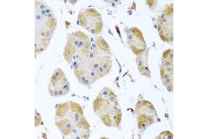 Immunohistochemistry of paraffin-embedded human stomach using MYLK antibody. (MYLK 抗体  (AA 1765-1914))