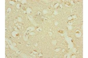 Immunohistochemistry of paraffin-embedded human brain tissue using ABIN7164317 at dilution of 1:100 (DHTKD1 抗体  (AA 1-280))
