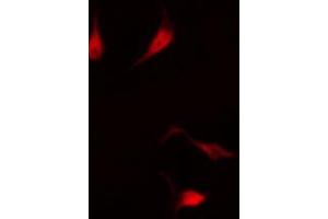 Immunofluorescence (fixed cells) (IF/ICC) image for anti-Forkhead Box O4 (FOXO4) (pThr451) antibody (ABIN6256565)