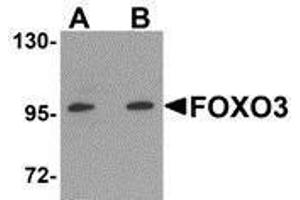 Western Blotting (WB) image for anti-Forkhead Box O3 (FOXO3) (N-Term) antibody (ABIN2473691) (FOXO3 抗体  (N-Term))