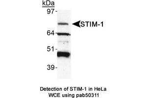 Image no. 1 for anti-Stromal Interaction Molecule 1 (STIM1) (AA 600-685), (C-Term) antibody (ABIN363620) (STIM1 抗体  (C-Term))