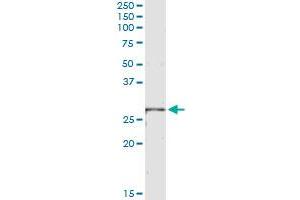 Immunoprecipitation of LRRK1 transfected lysate using anti-LRRK1 monoclonal antibody and Protein A Magnetic Bead , and immunoblotted with LRRK1 MaxPab rabbit polyclonal antibody. (LRRK1 抗体  (AA 560-659))