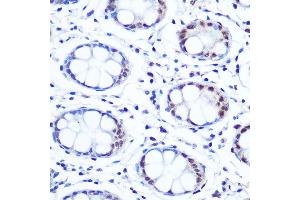 Immunohistochemistry (IHC) image for anti-Apurinic/Apyrimidinic Endonuclease 1 (APEX1) antibody (ABIN7265650)