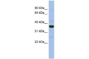 MYD88 antibody used at 1 ug/ml to detect target protein. (MYD88 抗体)