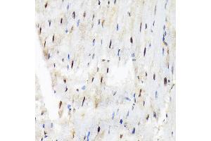 Immunohistochemistry of paraffin-embedded rat heart using SF3B3/S Rabbit mAb (ABIN7270544) at dilution of 1:100 (40x lens). (SF3B3 抗体)
