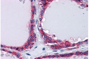Human Thyroid: Formalin-Fixed, Paraffin-Embedded (FFPE) (PLIN3 抗体  (AA 1-435))