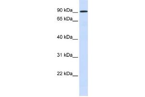 WB Suggested Anti-HKR1 Antibody Titration:  0. (HKR1 抗体  (N-Term))