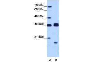 WB Suggested Anti-HNRPH3  Antibody Titration: 1. (HNRNPH3 抗体  (N-Term))