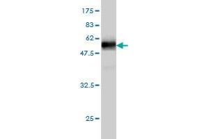 Western Blot detection against Immunogen (49. (HS1BP3 抗体  (AA 1-213))
