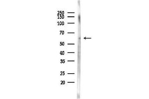 Western blot analysis of lysates from Hela cells(heat-shock 45 min treatment), using Cytochrome P450 11 Antibody at 1/1000 dilution.