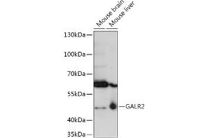 Western blot analysis of extracts of various cell lines, using G antibody (ABIN7267335) at 1:1000 dilution. (GALR2 抗体  (AA 50-150))