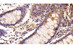 Immunohistochemistry (IHC) image for anti-3-Hydroxy-3-Methylglutaryl-CoA Reductase (HMGCR) (AA 638-887) antibody (ABIN7435559)