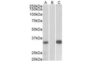 Western Blotting (WB) image for anti-Kv Channel Interacting Protein 3, Calsenilin (KCNIP3) (Internal Region) antibody (ABIN1105646) (DREAM 抗体  (Internal Region))