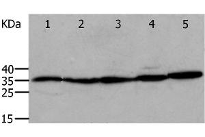 Western Blot analysis of Mouse eyes and heart, Human cervical cancer tissue, OP9 and RAW264. (Annexin V 抗体)