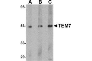 Western blot analysis of TEM7 in human liver tissue lysate with this product at (A) 0. (PLXDC1 抗体  (C-Term))