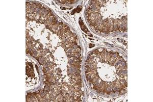 Immunohistochemical staining of human testis with CYB5R3 polyclonal antibody  shows strong cytoplasmic positivity in cells in seminiferus ducts and Leydig cells at 1:1000-1:2500 dilution. (CYB5R3 抗体)