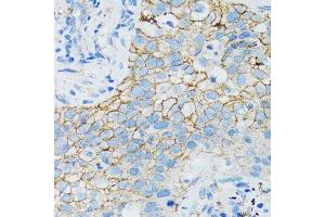 Immunohistochemistry (Paraffin-embedded Sections) (IHC (p)) image for anti-Catenin (Cadherin-Associated Protein), alpha 1, 102kDa (CTNNA1) (AA 637-906) antibody (ABIN6139202)