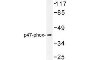 Image no. 1 for anti-Neutrophil Cytosol Factor 1 (NCF1) antibody (ABIN317896) (NCF1 抗体)
