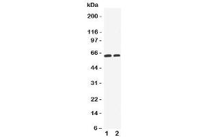 Western blot testing of OCT1 antibody and Lane 1:  HeLa (SLC22A1 抗体  (C-Term))